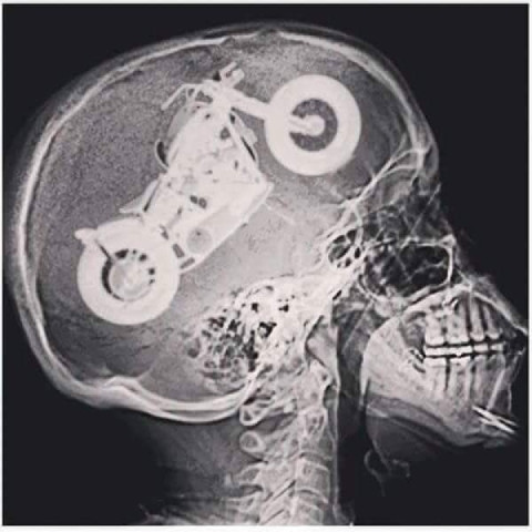 I got my results back