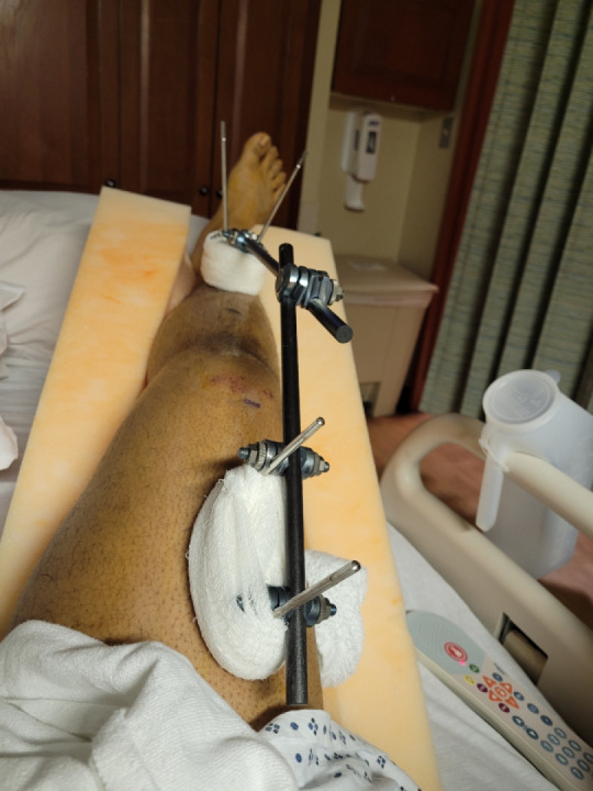 First of two surgeries and a reason to blow a check on my zx6